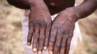 WHO to assess if monkeypox an international health emergency