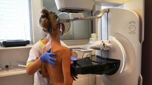 Cancers: la Cité des sciences ose l'exploration du "monstre"